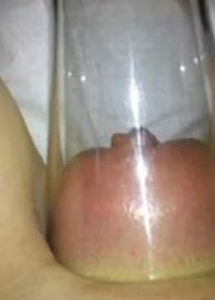 E sugar as tuas partes escondidas com ventosas?